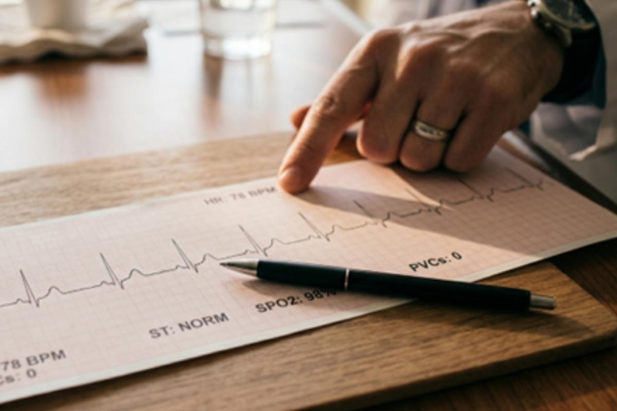 phillip zmijewski on the questions patients should be asking about their ekg
